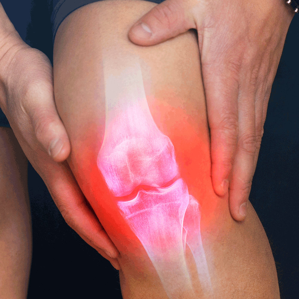Market analysis for new cartilage repair technology