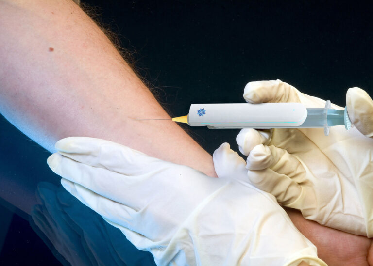igh-precision sensors developed at Tyndall help clinicians guide anaesthetic needles in the proximity of highly sensitive nerve and blood vessels to deliver anaesthetic doses with precision